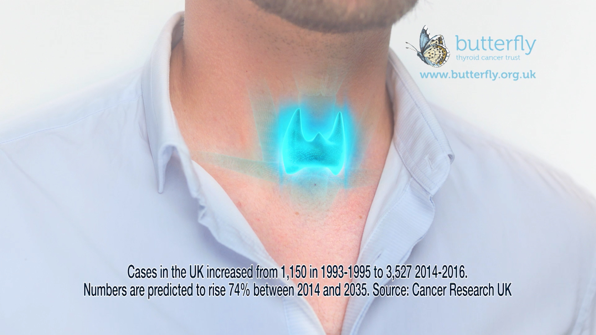 A 3D animation of a thyroid gland. From an awareness raising TV advert.